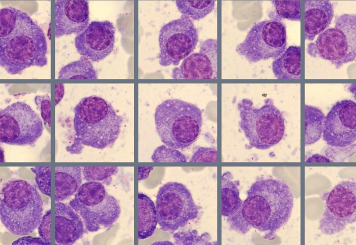 Monthly Cell Challenge #3 2026 Plasmacells