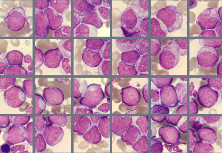 BMA Blasts Monthly Cell Challenge April 2026