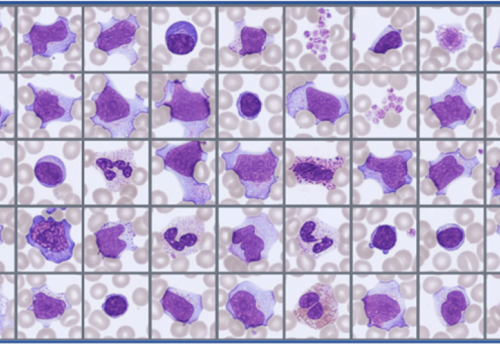 Sample of cells classified in the Global Test 2026:1