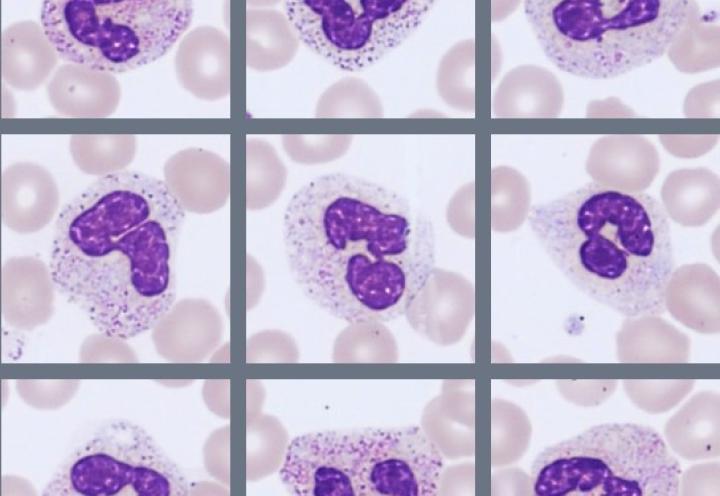 Neutrophils Monthly Cell Challenge July 2026
