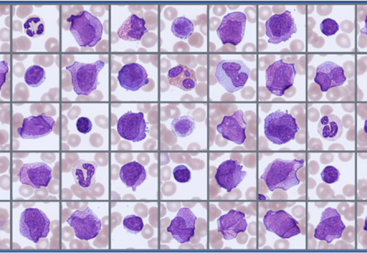 Sample of cells classified in the Global Test 2026:2 