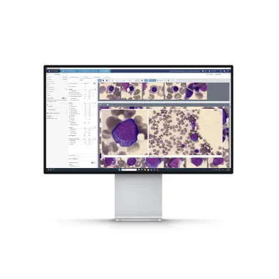 Bone marrow application software