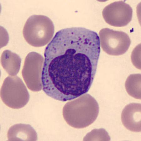 Interesting shape cells - Apple