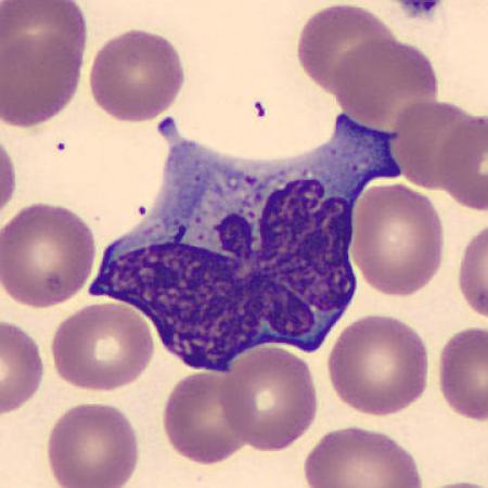 Interesting shape cells - Butterfly