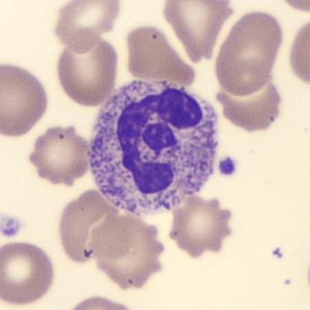 Neutrophil alphabet - E