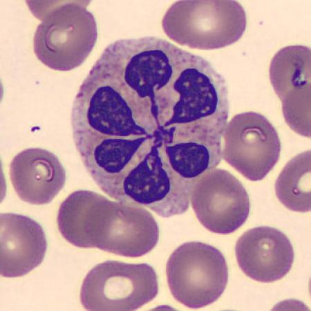 Interesting shape cells - Flower
