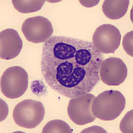 Interesting shape cells - Happy face