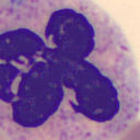 Neutrophil alphabet - K or X