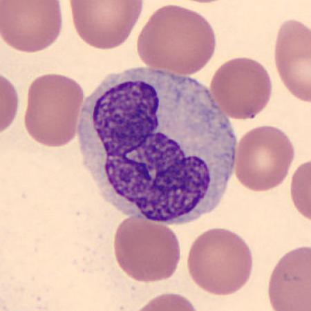 Interesting shape cells - Parent and baby