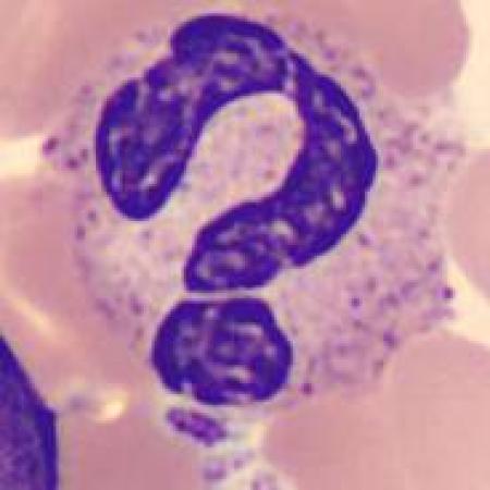 Interesting shape cells - Question mark