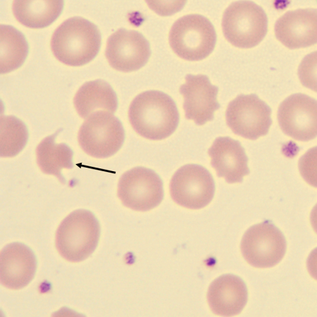 Acantho1