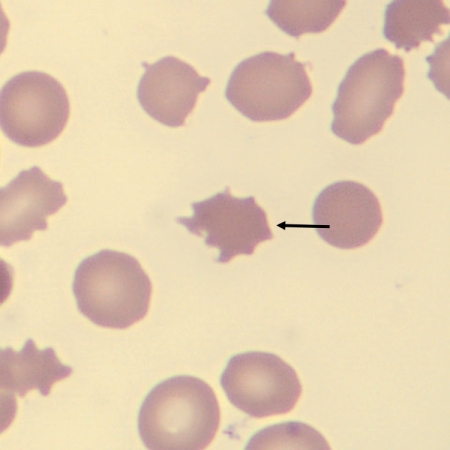 Acantho2