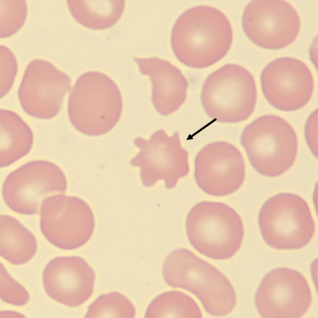 Acantho3