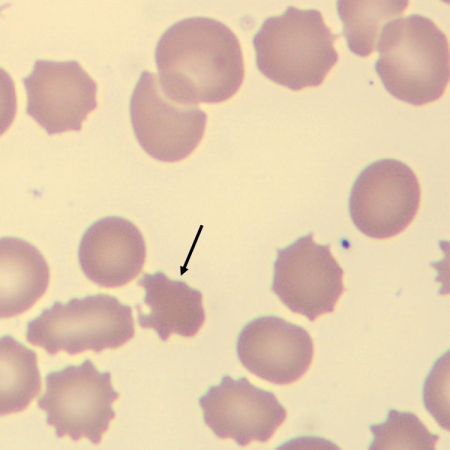 Acantho4