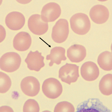 Acantho5