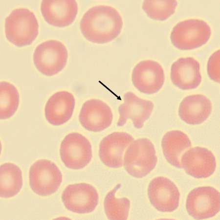 Acantho6