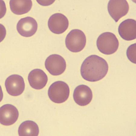 Aniso2