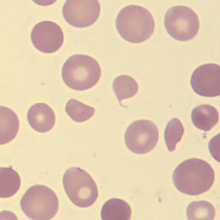 Aniso5