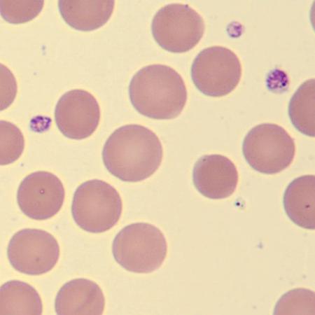 Aniso6
