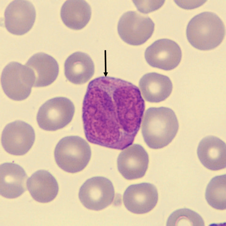Auer3