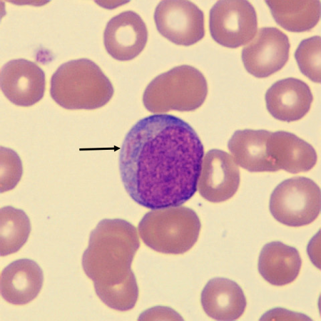Auer5