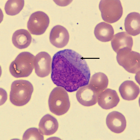 Auer6