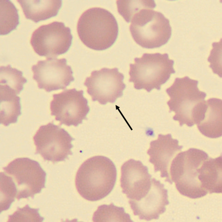 Echino1