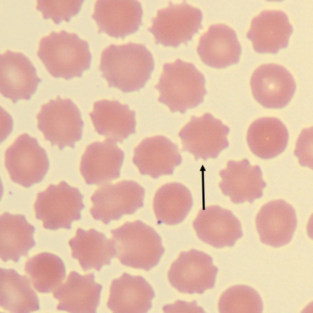 Echino3