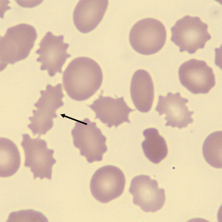 Echino5