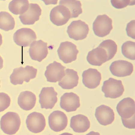Echino6