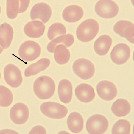 Elipto2