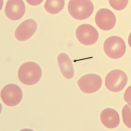 Elipto3
