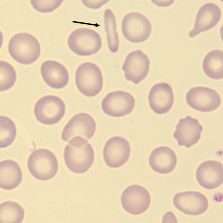 Elipto6