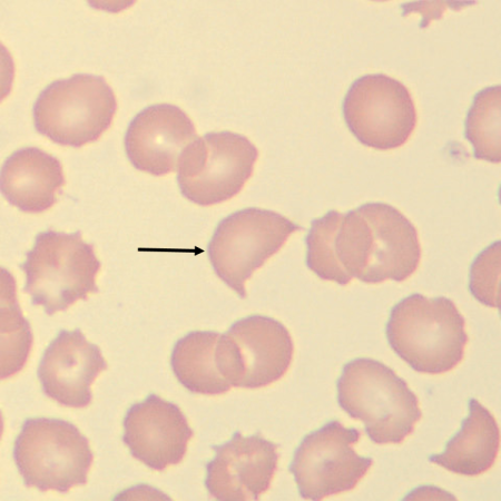 HC2