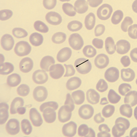 HC4