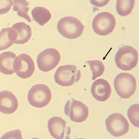 HC6