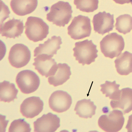 Hypo1