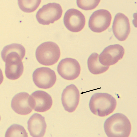 Hypo2