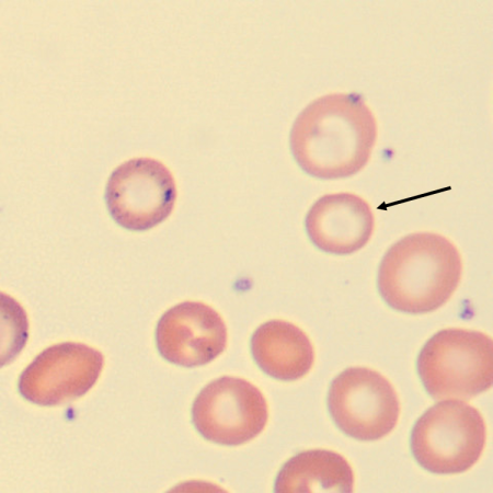 Hypo3