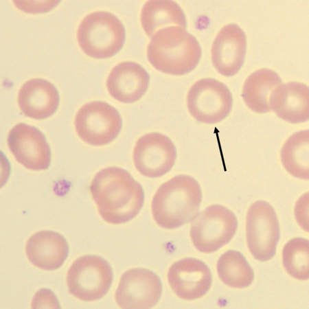 Hypo4