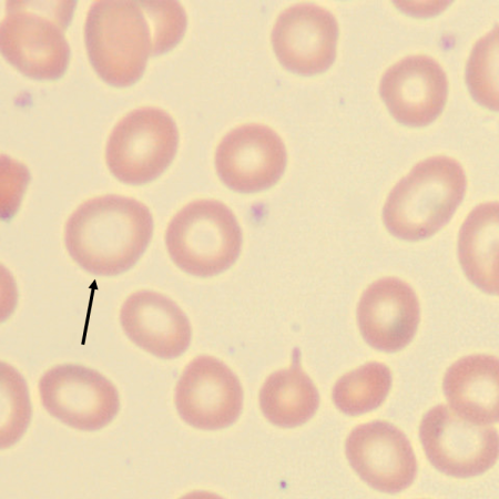 Hypo5