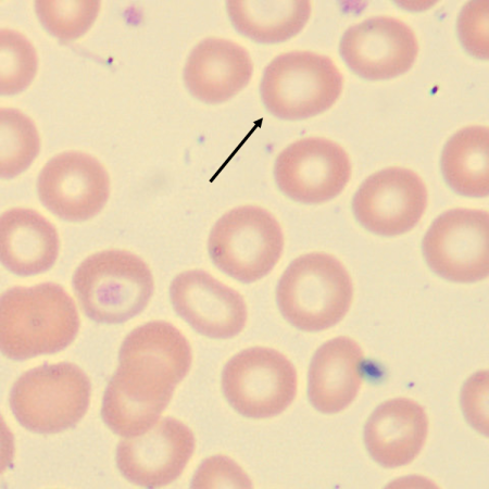 Hypo6
