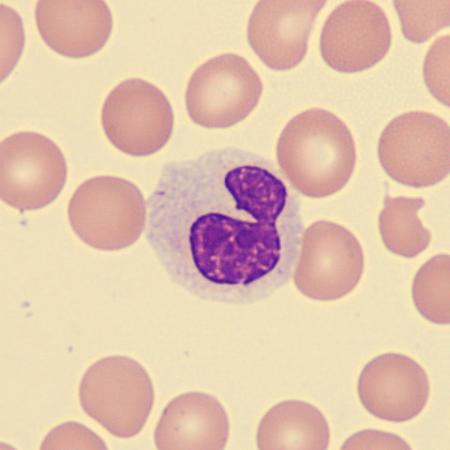 Hypogran2