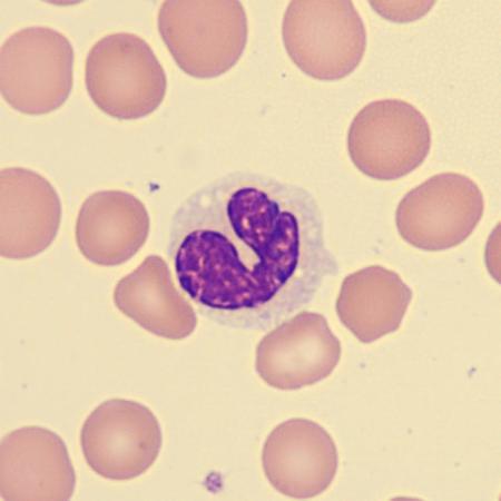 Hypogran3