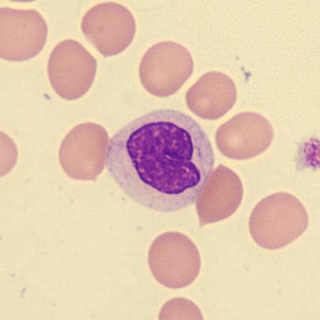 Hypogran4
