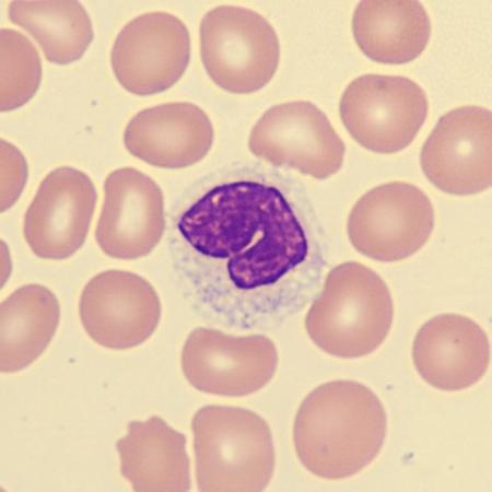 Hypogran5