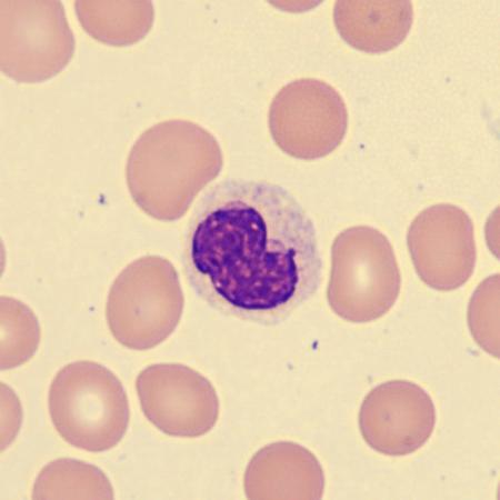 Hypogran6