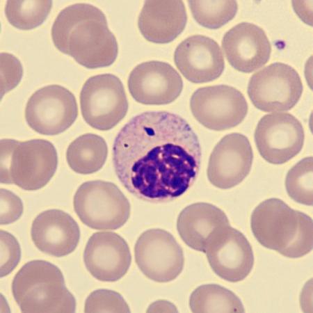 Hyposeg1