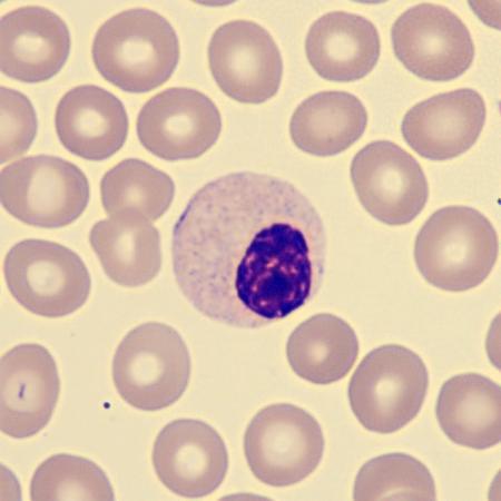 Hyposeg2