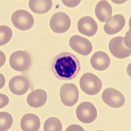 Hyposeg3